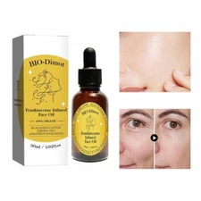 Frankincense Face Oil for Brightening and Clearing Skin Tone D3P7