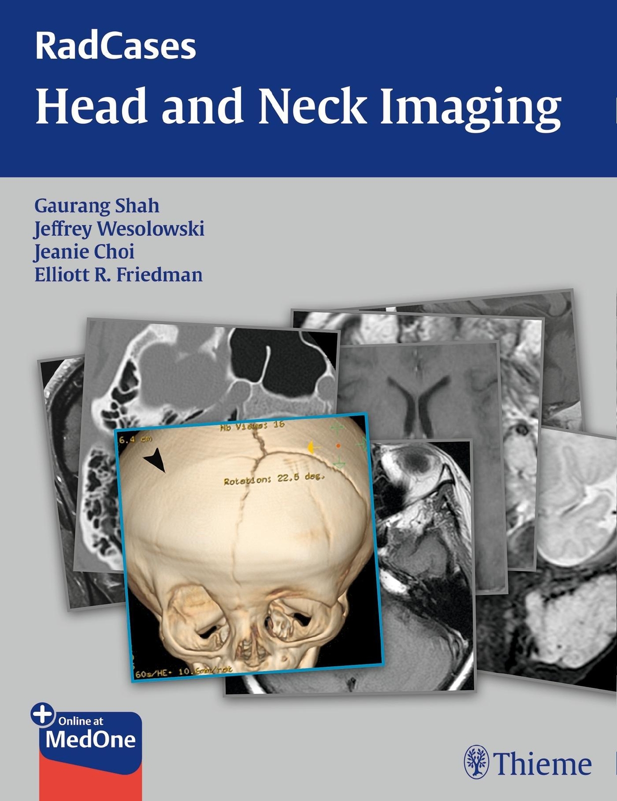 Thumbnail - Radcases Head And Neck Imaging | Gaurang Vrindavan Shah (u. A.) |