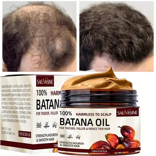 2er Pack natürliches Batanaöl für Haarwachstum gesünder dicker voller Anti Haarausfall - Bild 17 von 24