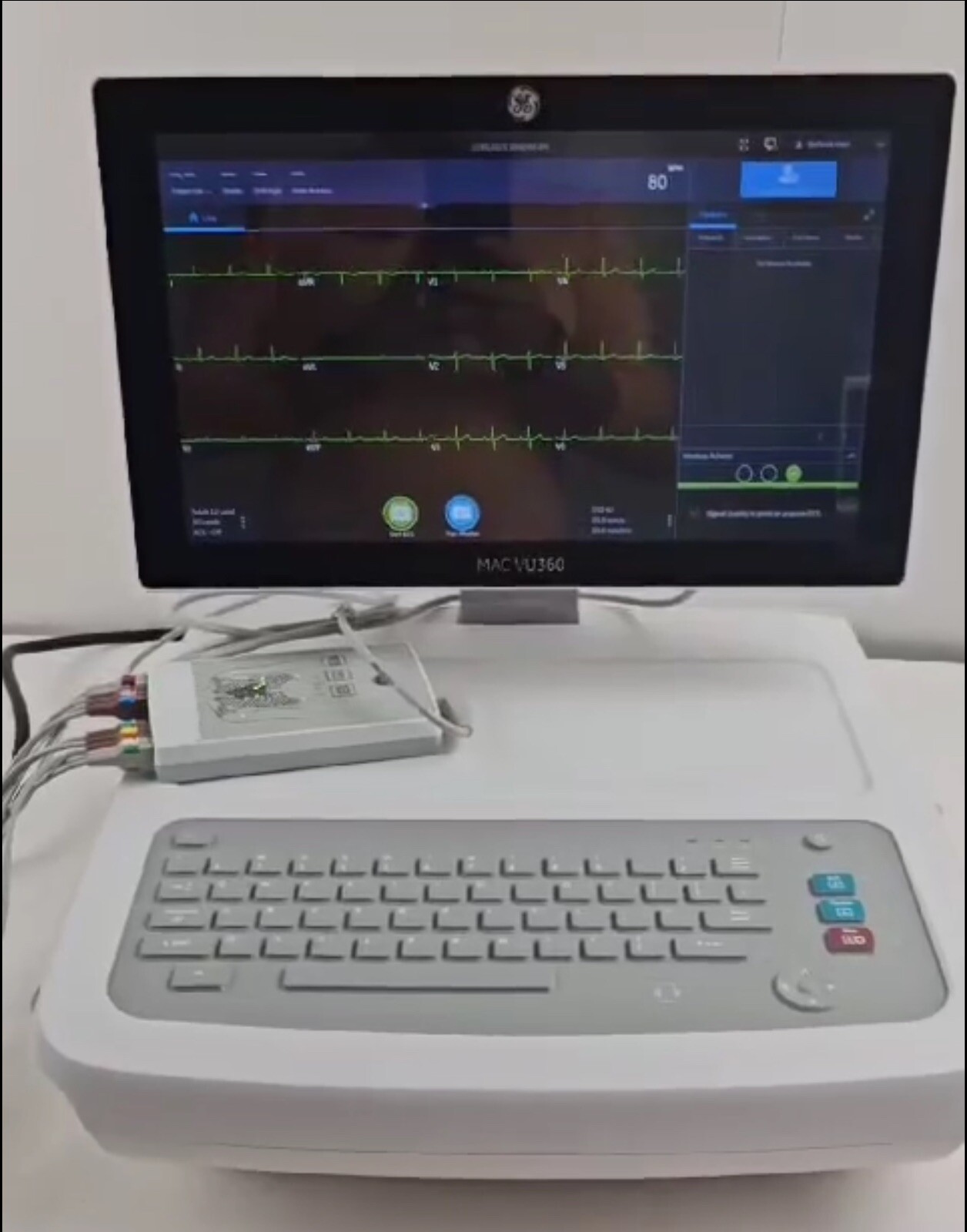 GE MAC VU360 With Cam Connect 14 And Interface Cable. eBay