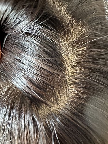 5.5"X6"Silk Top 110% Density Real Best Virgin Human Hair Topper for Women 8"~20" - Picture 8 of 12