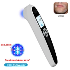 55mW/cm2 308nm Excimer Uvb Phototherapy Light Treatment for Skin Diseases Device