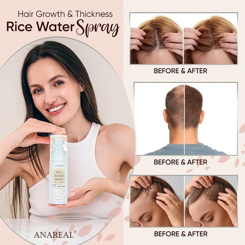 HAIR GROWTH SERUM RICE WATER FOR HAIR GROWTH RICE WATER HAIR SPRAY W/ CASTOR OIL