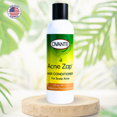 Ovante Acne Zap Haarspülung 6oz Behandlung Kopfhaut Akne, juckende & fettige Kopfhaut - Bild 1 von 6