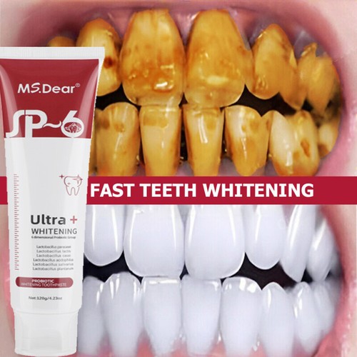 2025 SP-6 Probiotic Toothpaste,Sp-6 Toothpaste Whitening Quick White Toothpaste - Picture 7 of 21