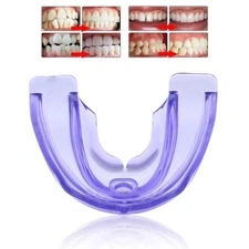 Myobrace Tooth Orthodontics Braces Veneers Anti Molar