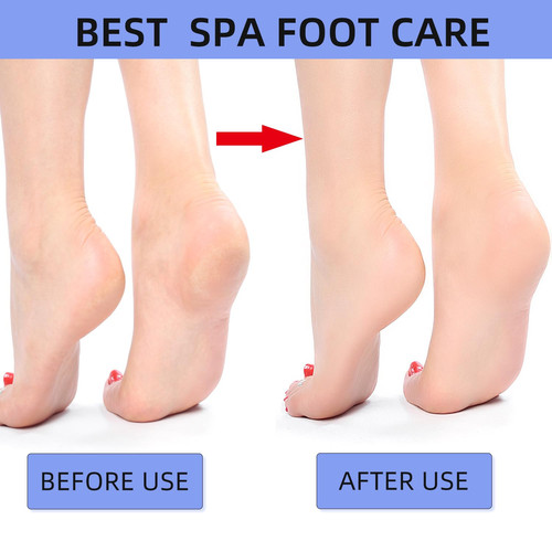 3 Pcs Foot Pumice Stone for Feet Hard Skin Callus Remover and Scrubber for Fe... - Picture 5 of 9