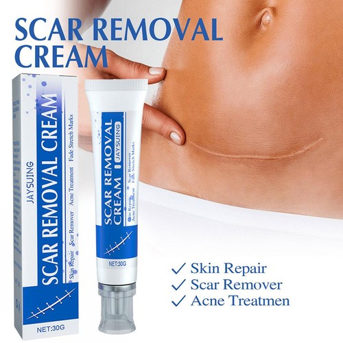 1-3X SCAR REMOVAL CREAM Skin Repair Scar RemoverFade Stretch MarkAcne Treatment - Picture 8 of 16