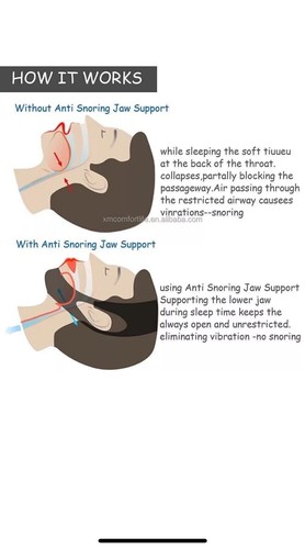 ANTI SNORING Devices Kit MOUTH GUARD SLEEP AIDS Anti Snore Chin Guard Nose Vents - Picture 6 of 11
