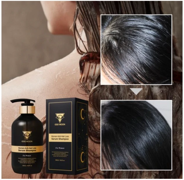 Odumun Anti-Hair Loss Serum Shampoo 500ml For Man Woman Result Within 2 Weeks