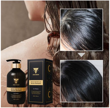 Odumun Anti-Hair Loss Serum Shampoo 500ml For Man Woman Result Within 2 Weeks