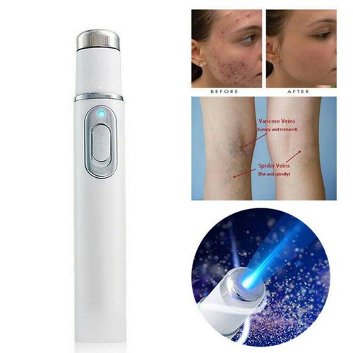 Blue Light Therapy Wrinkle Acne Laser Pen Scar Removal Device Spider Vein Eraser - Picture 2 of 12