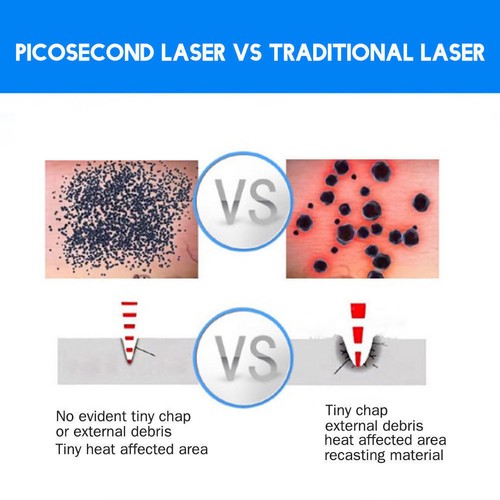 Nueva Terapia Por Mano Picosegundo Pluma II Láser Azul para Eliminar Manchas Cicatrices Tatuajes EE. UU. - Imagen 8 de 8