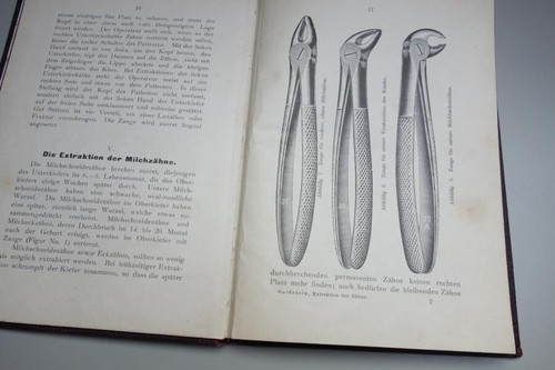 Dentista La extracción de los dientes 1909 Goldstein Dentista Técnico dental Médico Diente - Imagen 3 de 3