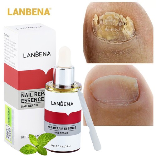 LANBENA Nail Repair Essence Oil Remove Onychomycosis Serum Fungal Nail Treatment - Picture 4 of 22