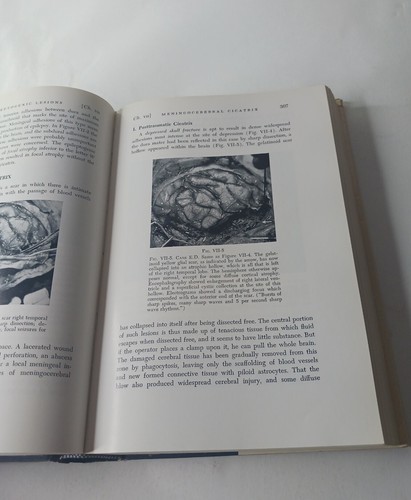 Epilepsy and the Functional Anatomy of the Human Brain by Penfield HC (1954) - Imagen 16 de 24