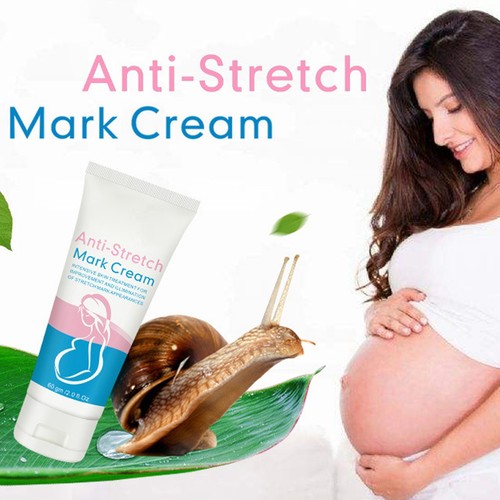 Anti-stretch Mark Lifting Cream Scar Repair 60g AU PLM - Picture 5 of 12