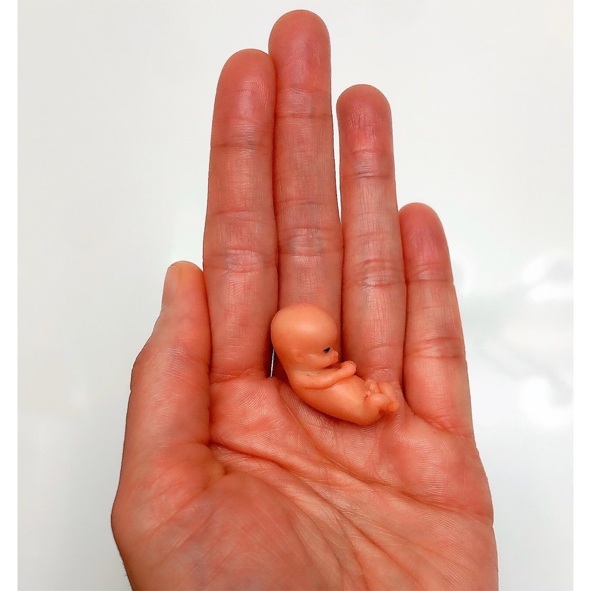 10 Weeks Baby Fetus, Stage of Fetal Development (Memorial