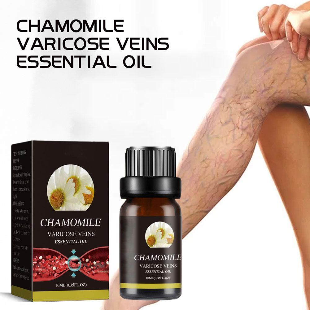 Marronie Chamomile Essential Oil for Varicose Veins Treatment Leg