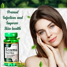 Cipzer Eczema Total Skin 60 Capsules |Removes Eczema & Replenishes Skin Moisture