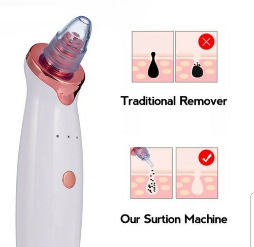Electric Blackhead Remover Pore Vacuum Suction Diamond Dermabrasion Face Cleaner - Picture 5 of 8