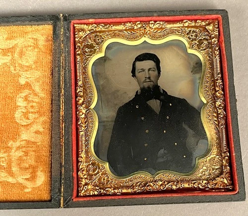1/6 PLATE TINTYPE CIVIL WAR UNION SOLDIER, BRASS BUTTONS (NOT A DAGUERREOTYPE)