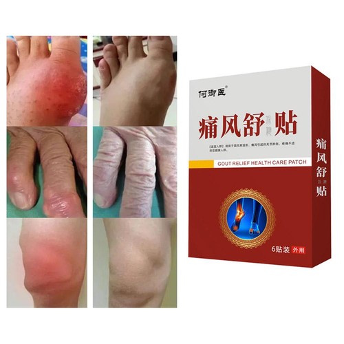 18pcs Gout Relief Patch for Gout & Joint Pain Relieves Redness Swelling- Heat - Picture 2 of 15