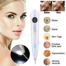Laser Plasma Pen Mole Removal Dark Spot Skin Tag Tattoo Beauty Remover US STOCK