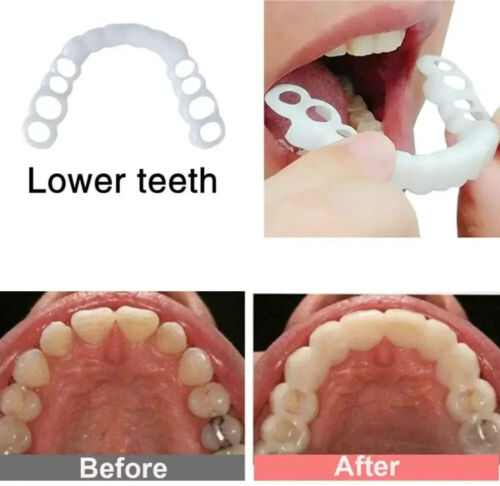 2 Stück Perfekte Passform Zahnaufhellung Gefälschte Zahnabdeckung Snap On Silikon Lächeln Veneers - Bild 14 von 18