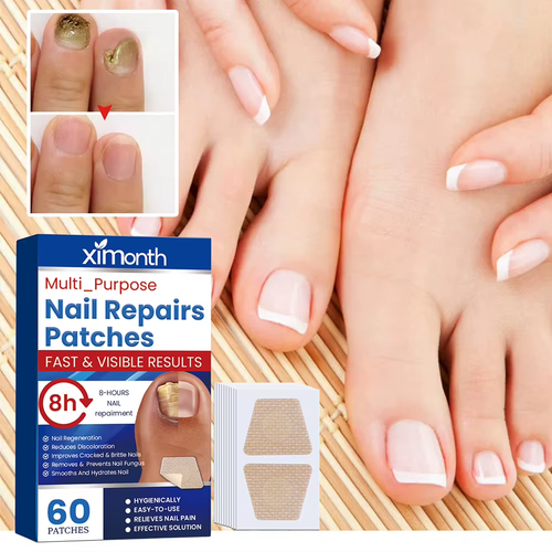 60Pcs Toenail Fungus Patch Waterproof Nail Repair Patches Nail Ingrown Correctio - Picture 4 of 6