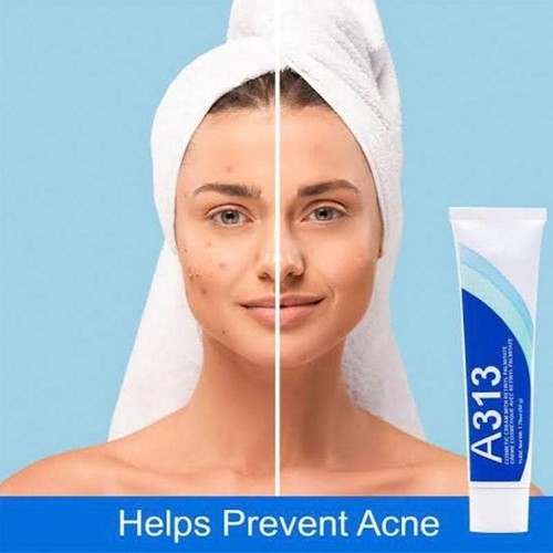 A~313 Vitamin A Retinol Cream 50G - Picture 10 of 10