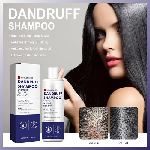 Folliculitis Itch Relief Shampoo Anti Dandruff Shampoo Seborrheic Dermatitis ... - Picture 9 of 11