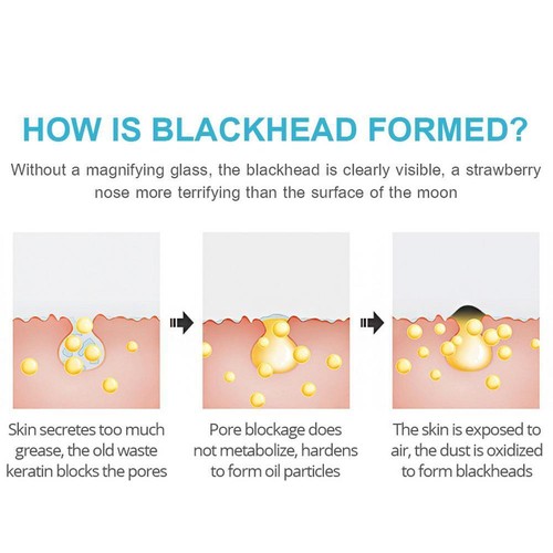 ☮Bambuskohle-Mitesserentferner, Peel-Off-Nasenmaske zum Poren-Reinigen 30ml - Bild 8 von 11