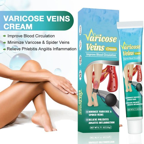 Varicose Vein Cream Herbal Varicose Veins Treatment Cream for Legs Spider 20g - Picture 3 of 12