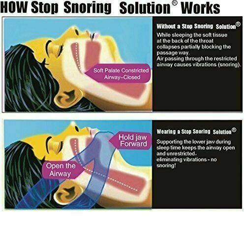 Snore Stop Belt Sleep Apnea Jaw Solution Anti Snoring Cpap Blue Chin Strap - Picture 5 of 5