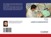 Lasers IN Endodontics Munish Singla