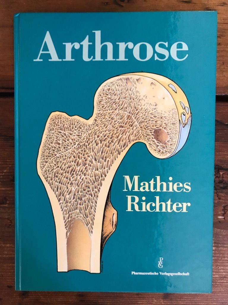 Arthrose am Beispiel des Hüftgelenkes Mathies, H., I.-E. Richter und G. Puchner