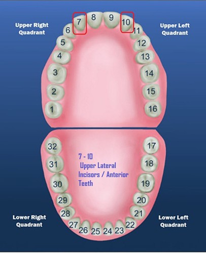 Dental Polycarbonate Temporary Preform Crowns Refills Set of 5 per Bag See Chart - Picture 5 of 75
