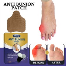 New Strong joints Anti Bunion Patch Relief Patches Corrector for Toe Pain Relief