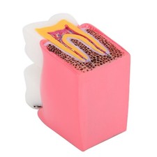 Caries Comparison Study Models Dentist Dental Anatomy Education Teeth Model