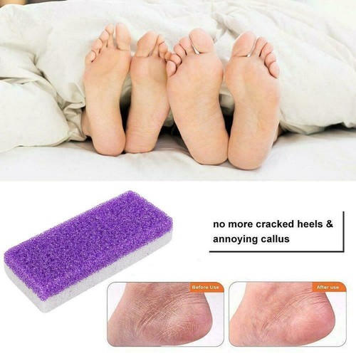 Spugna Pomice Piedi Callo Pietra Esfoliante Pelle Dura Scrubber Pedicure I8X5 - Foto 8 di 9