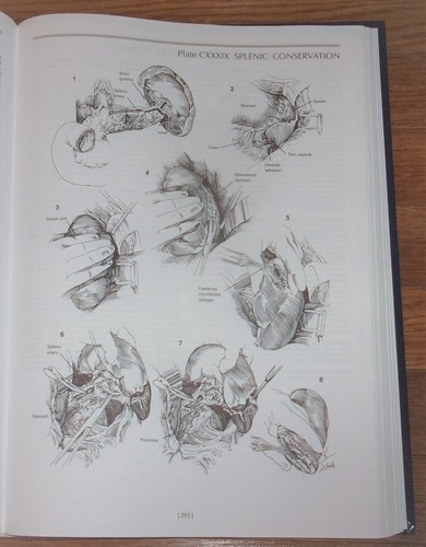 ZOLLINGER'S ATLAS OF SURGICAL OPERATIONS-Eighth Edition-SUPERB Oversized HC oop! - Picture 10 of 11