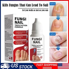 Fungi Nail Anti Fungal Liquid Formula Nail Repair Liquid Solution