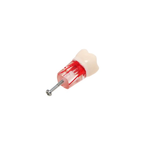 10 pezzi denti canale radicolare endo dentale modello studio RCT pratica modello Typodont #8006 - Foto 61 di 63