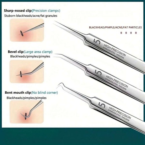 10pcs Blackhead Remover & Pimple Popper Kit – Stainless Acne Tool Set - Picture 8 of 11