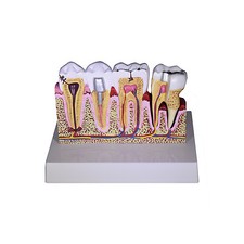 Redland  Dental Demonstration Teeth Educational Model -3339 Model 4
