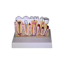 Redland  Dental Demonstration Teeth Educational Model -3339 Model 4