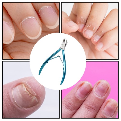 Toenail Clippers For Seniors Nail Clippers For Professional Podiatrist chic - Picture 4 of 5