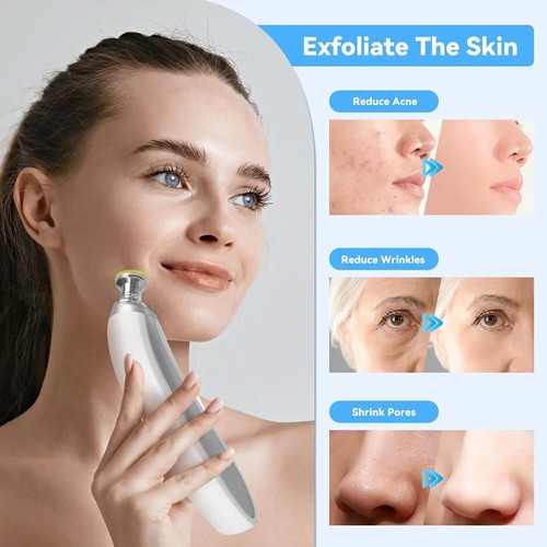 Upgraded Diamond Microdermabrasion Machine Blackhead Removal Professional Facial - Picture 8 of 9