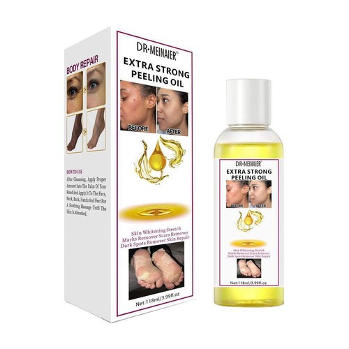 118ml Strong Yellow Peeling Oil Exfoliating Solution Body Dark For Face V3H0 - Picture 6 of 12